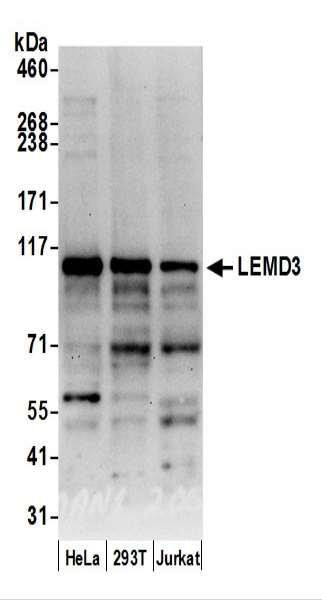 Anti-LEMD3/MAN1