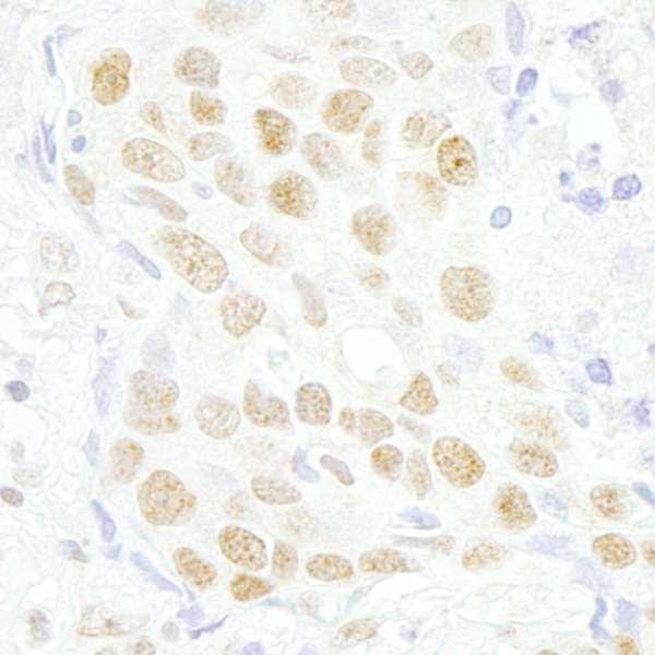 Anti-MAZ/SAF-1 (IHC)