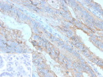 Anti-P-Cadherin / CDH3, clone r56C1