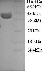 ELAV-like protein 3 (ELAVL3), human, recombinant