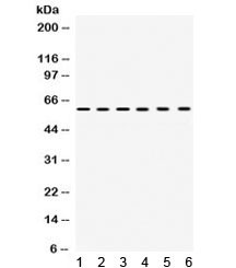 Anti-TCP1 alpha / CCT1