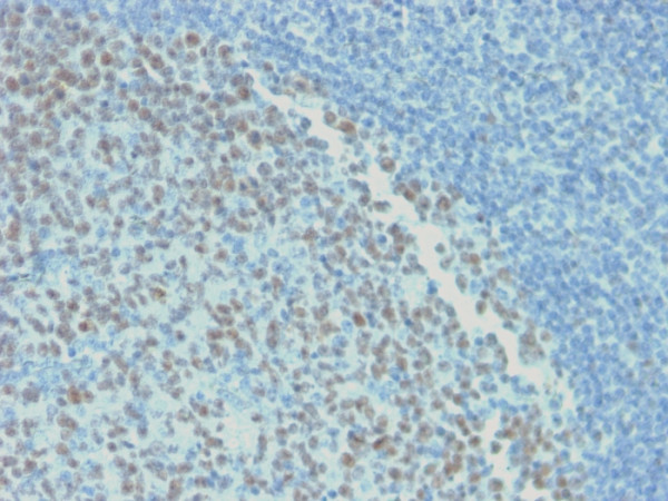 Anti-Bcl-6 (Follicular Lymphoma Marker), recombinant antibody, clone rBCL6/1718