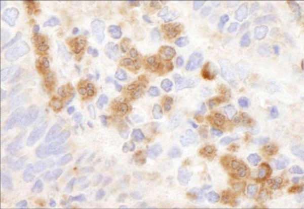 Anti-G6PD (IHC)