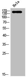 Anti-Phospho-NTRK3 (Y516)