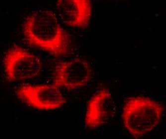 Anti-AMPK beta 1, clone 1A7-E11-E9