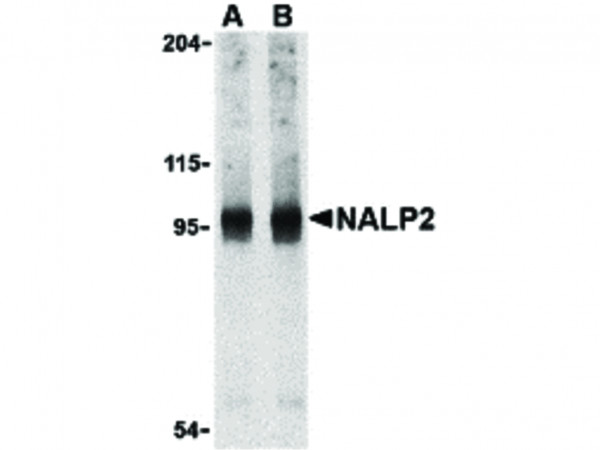 Anti-NALP2