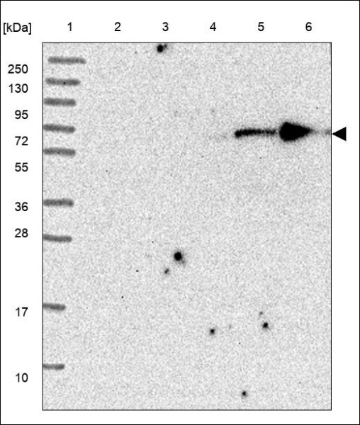 Anti-KLHL23