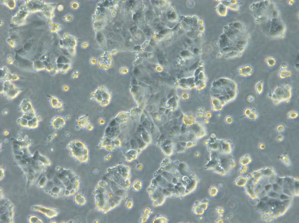 HROC285 T0 M2 Cells