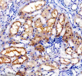 Anti-TRAIL-R4 / TNFRSF10D / TRUNDD, clone 23T76