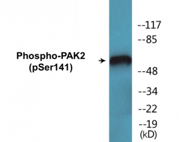 PAK2 (Phospho-Ser141) Colorimetric Cell-Based ELISA Kit