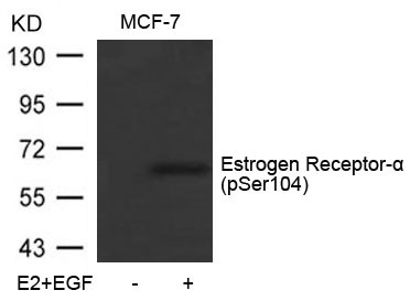 Anti-phospho-Estrogen Receptor alpha (Ser104)