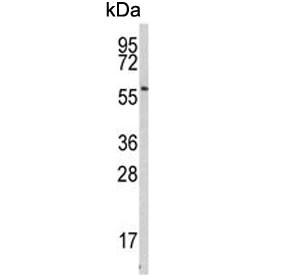 Anti-Beta-secretase 1 / Memapsin-2 / BACE1C