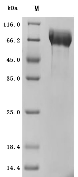Mucin-13(MUC13), partial (Active), recombinant human