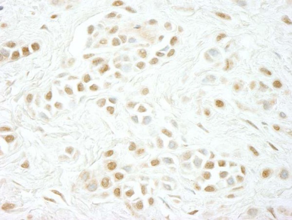 Anti-Cyclin C (IHC)