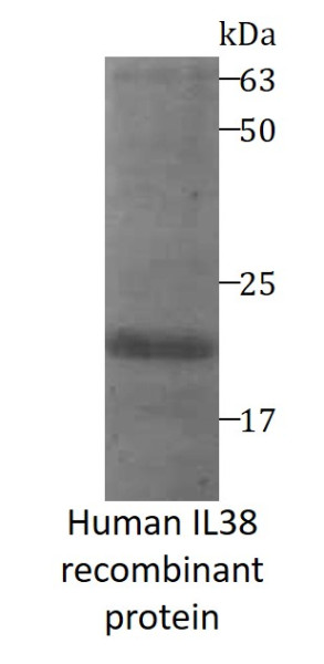 Human IL38 recombinant protein (His-tagged)
