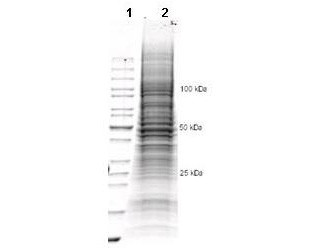 Human Derived U-2OS Whole Cell Lysate (Ready-to-Use)
