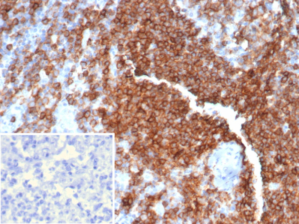 Anti-CD39 / ENTPD1 (Marker of Tumor-specific T cells), clone CD39/6860