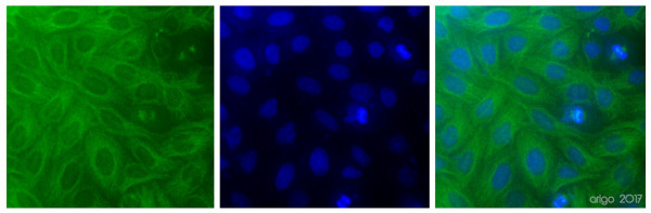 Anti-beta Tubulin, clone 1E1-E8-H4
