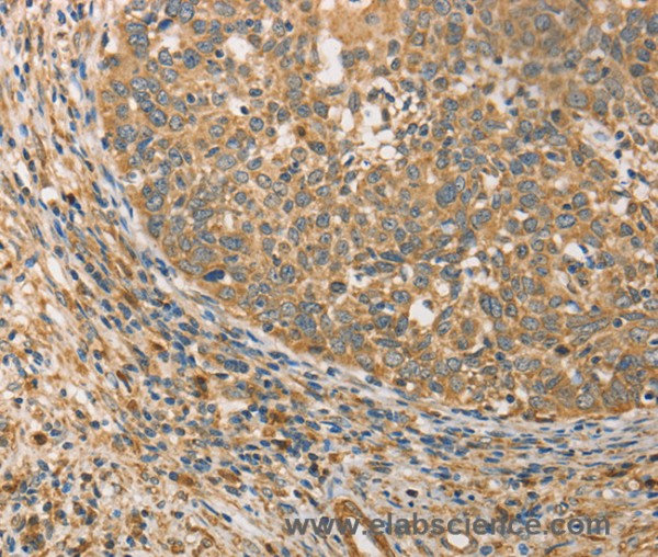 Anti-ATG3