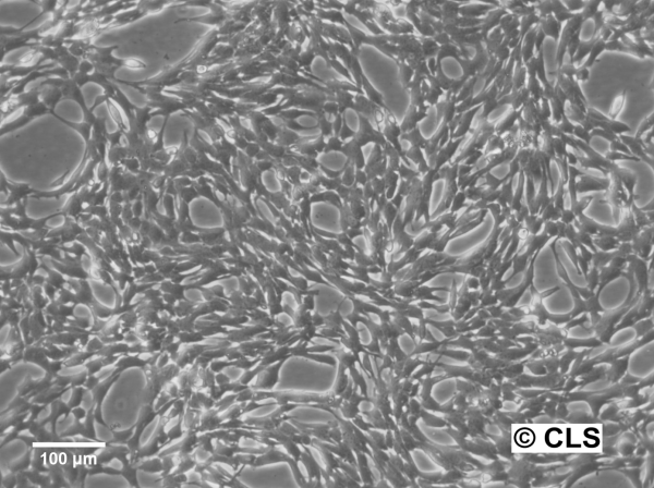 Hep-74.3A Cells