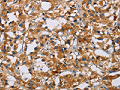 Anti-NRN1