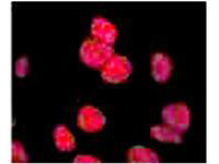 Anti-phospho-ATM Protein Kinase (Ser1981), Biotin conjugated, clone 10H11.E12