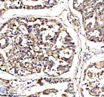 Anti-DNAJB6 / DnaJ homolog subfamily B member 6