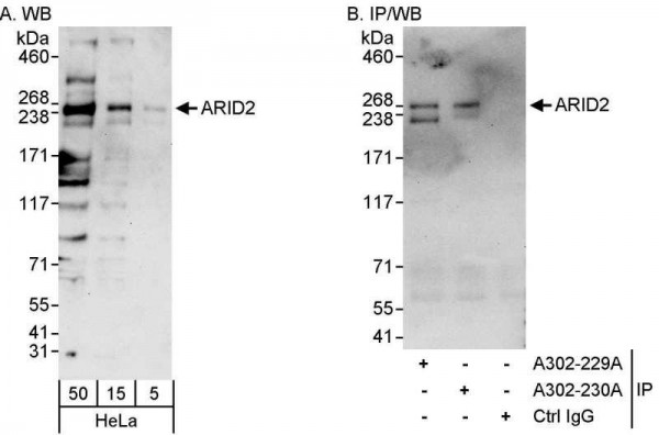 Anti-ARID2