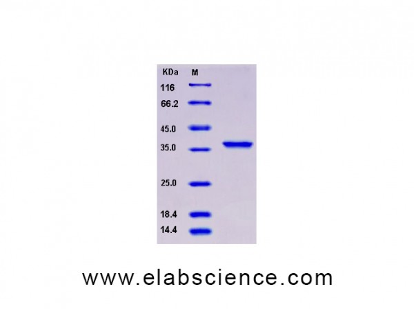 Recombinant Human COL2A1 Protein (aa 1242-1487, His tag)