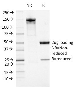 Anti-ATRX / RAD54 (Alpha Thalassemia Mental Retardation), clone 23c