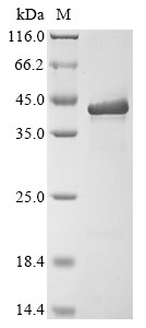 Matrix protein VP40 (VP40), Zaire ebolavirus, recombinant