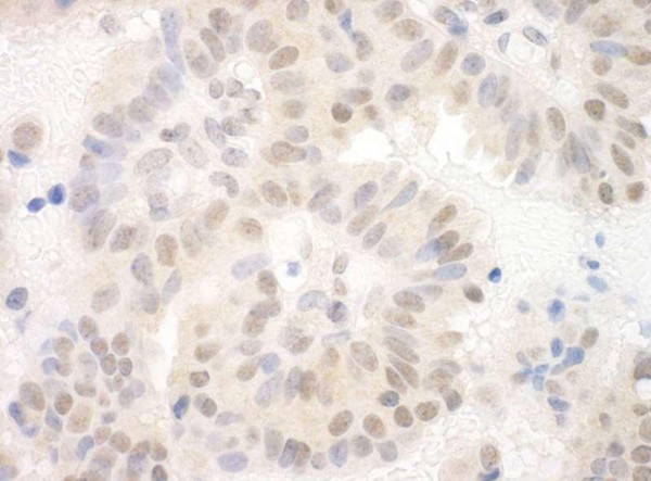 Anti-SAP130 (IHC)