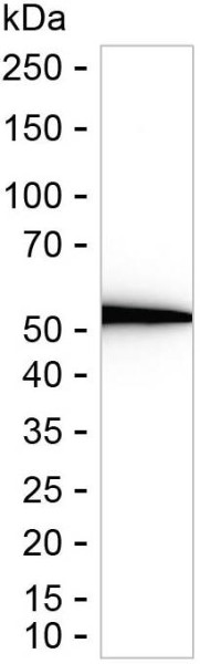 Anti-HMGCS1
