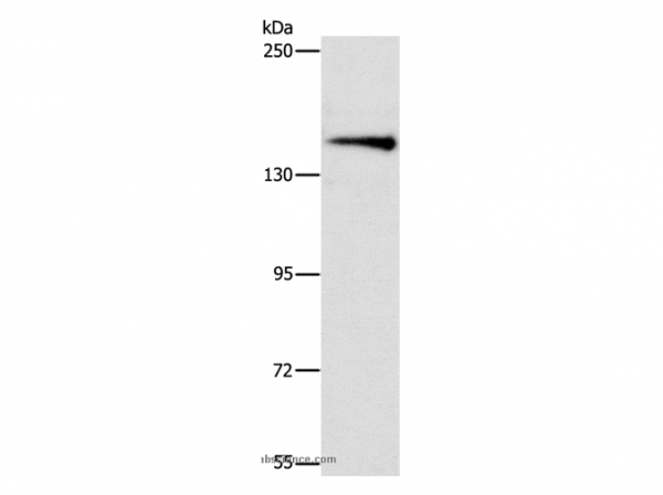 Anti-ARHGEF11