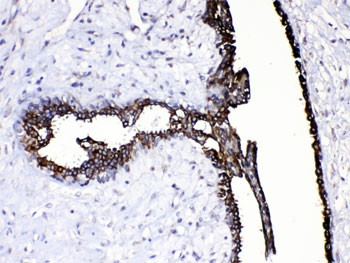 Anti-CASP8 / Caspase 8 (small subunit)