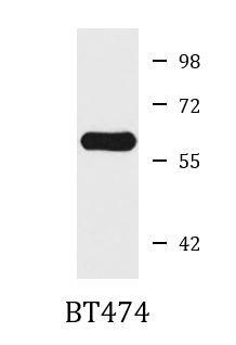 Anti-CCT5 / TCP1 epsilon