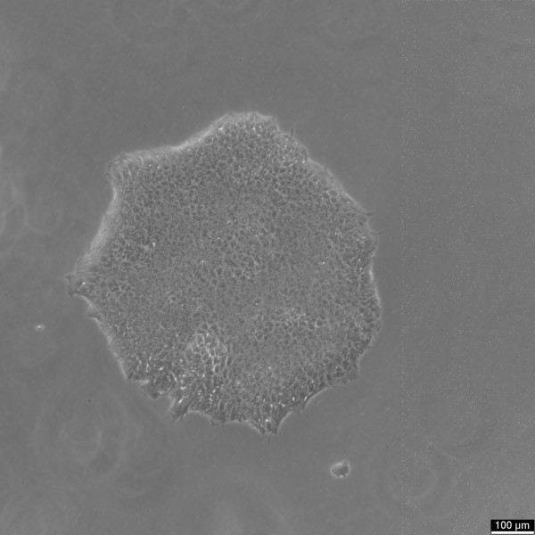 iPSC-hDPSC