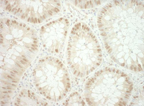 Anti-RuvBL2 (IHC)
