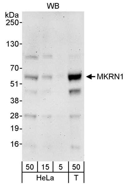Anti-MKRN1