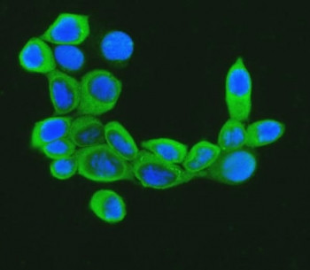 Anti-Cofilin 1