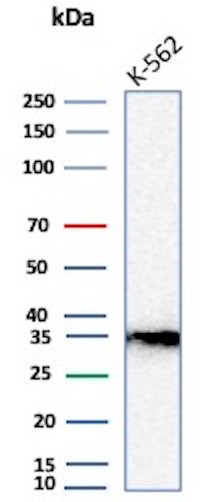 Anti-Carbonic Anhydrase VIII, recombinant antibody, clone rCA8/8835