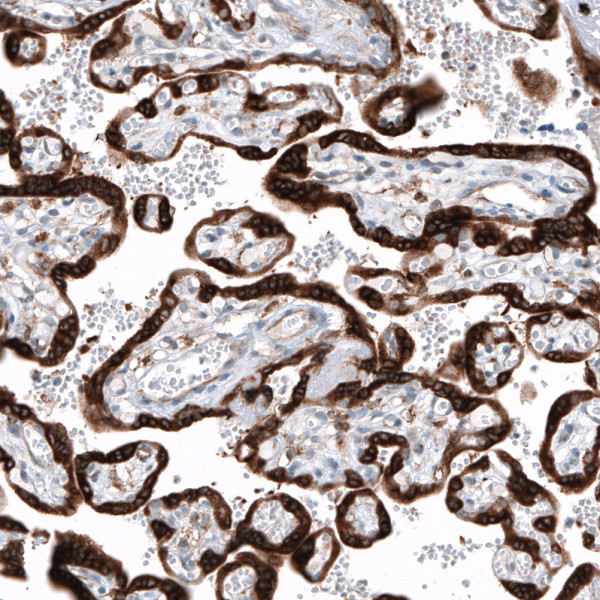 Anti-IGF2BP3