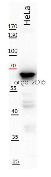 Anti-MMP-1, clone SB12e