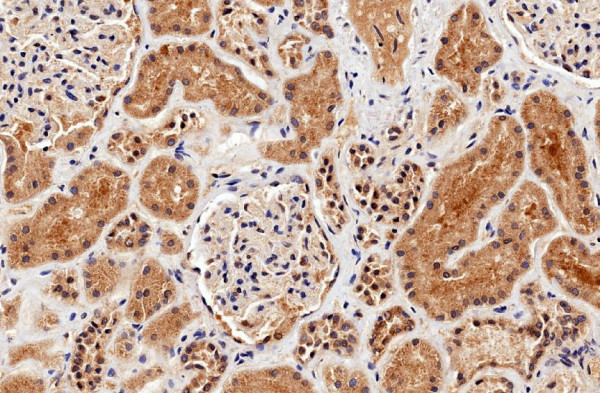 Anti-Arginase I, C-terminal