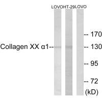 Anti-COL20A1