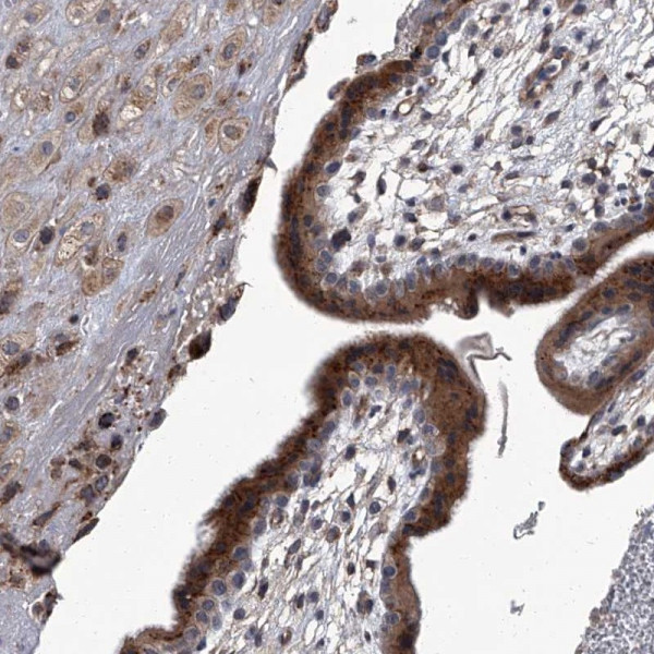 Anti-SIRT4