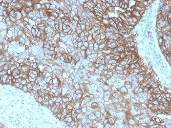 Anti-PD-L1 / B7-H1 / CD274, clone rPDL1/4772