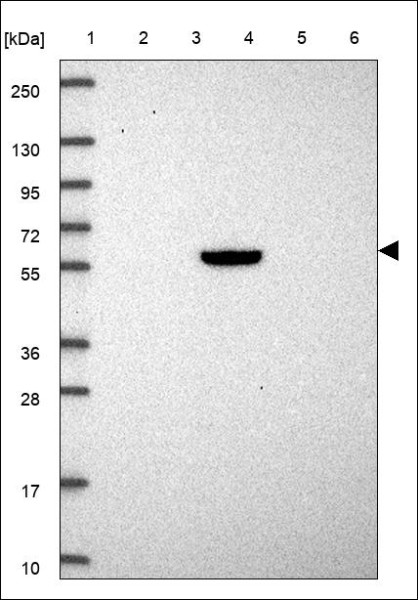 Anti-CSGALNACT1