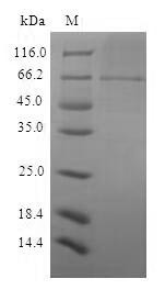 Structural polyprotein, partial, Sindbis virus, recombinant