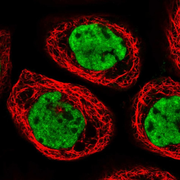 Anti-CPSF6
